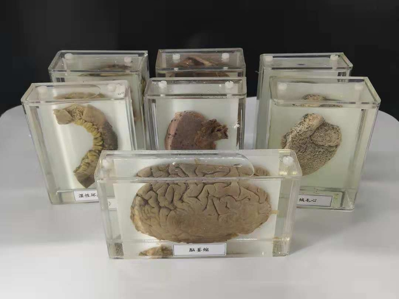 人動物病體大體標本