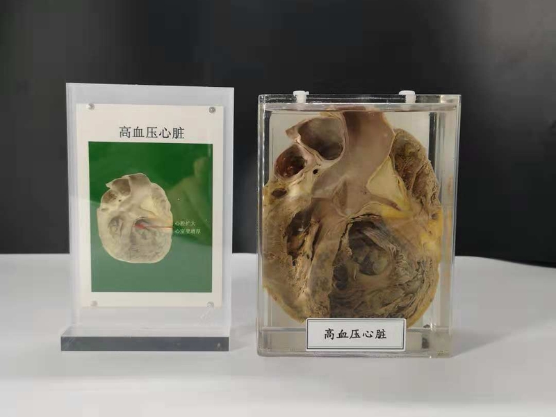 人動物病體大體標本