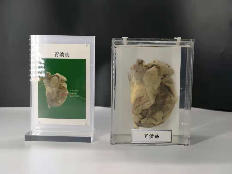 人動物病體大體標本